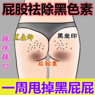 网红屁股臀部去黑坐印大腿内侧根部去黑色素私密处美白除黑沉淀祛