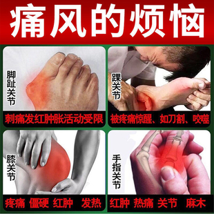 网红手指关节粗大变形肿大新版痛风特效药降尿酸消结晶僵硬疼痛理