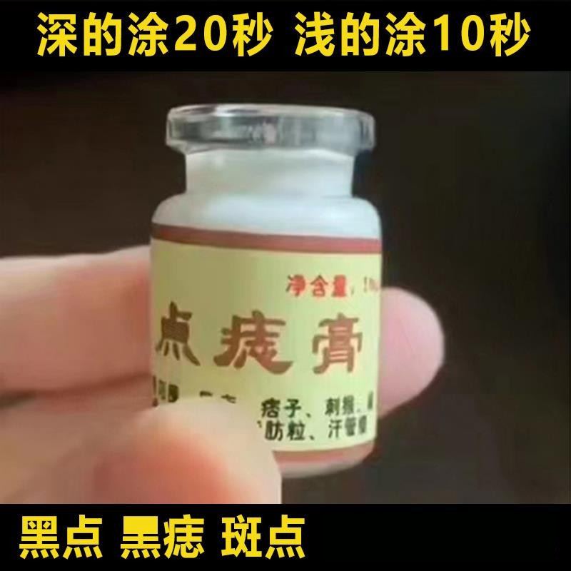 屈臣氏精选】点志膏脸部专用除志去黑志祛志神器无痕正品旗舰店