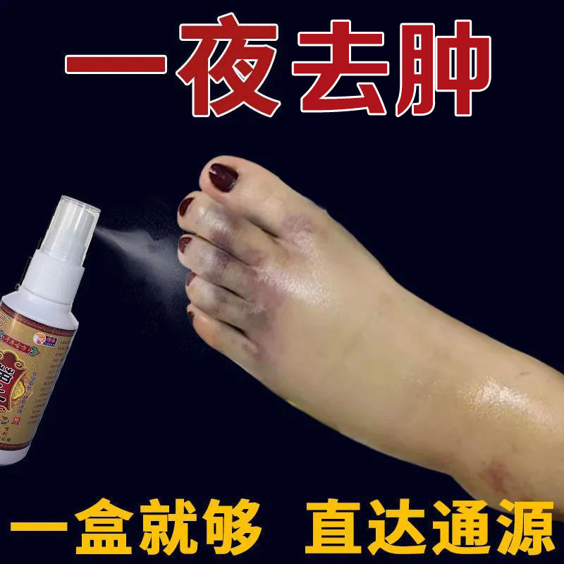 苗王五毒追风液脚踝扭伤手脚背消肿止痛活血散瘀外用去水肿特效药
