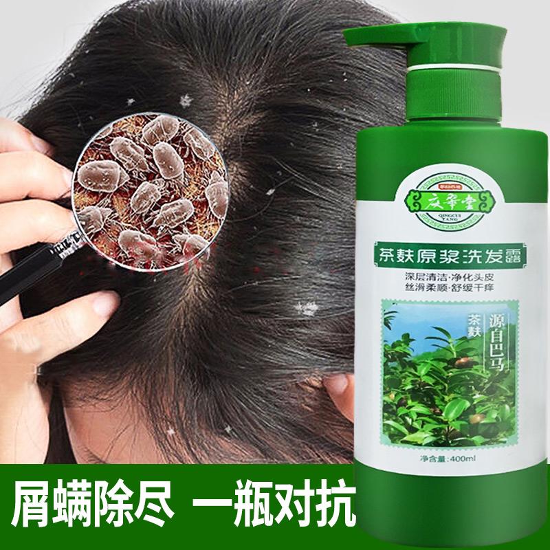 茶麸洗发水露去屑名除螨虫排行榜止痒控油官方品牌 u[2702472533]