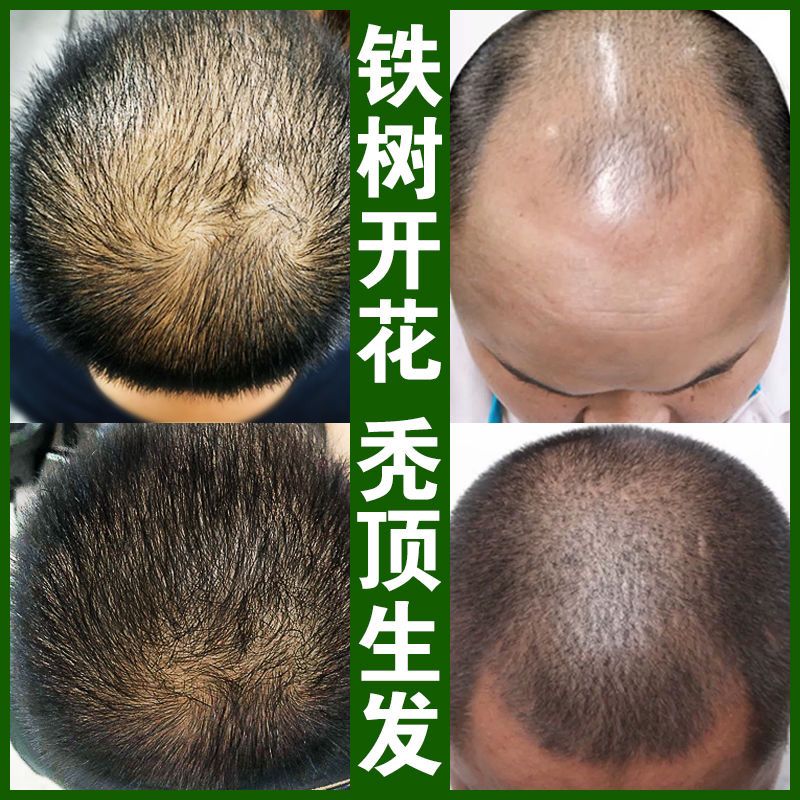 一折头发增长液 变长发_头发增长液防脱发生发增发密发育发液洗发水育