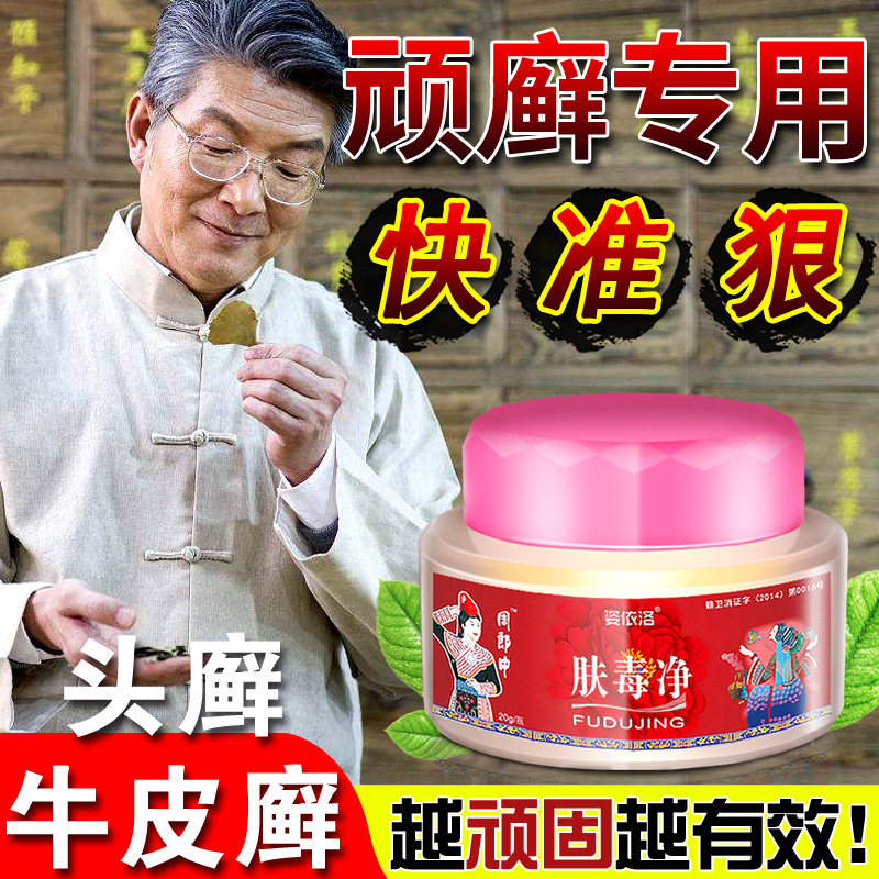 牛皮癣专用药膏银屑癣手足股藓外用癣藓特效药膏股癣大腿内侧瘙痒