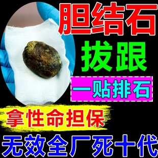 治疗胆结石特效药溶石化石排石草碎石金钱专用胆囊息肉专用中药贴