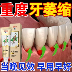 【花椒】牙龈萎缩修复再生专用牙膏红肿牙周炎出血牙根暴露敏感