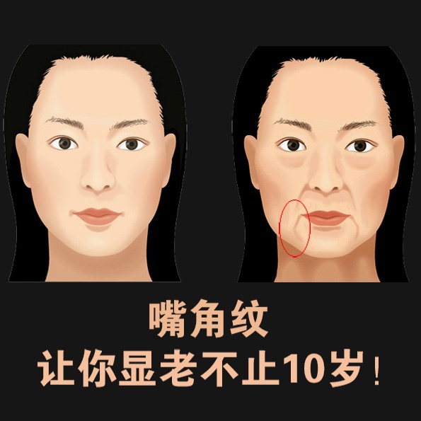 热销医朵_法令纹贴去八字嘴角 神器 胶原蛋白提拉紧致 补水保湿面膜贴