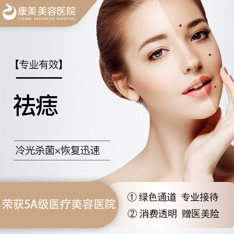 康美美容整形 祛痣 新客限购一次 2mm内一颗