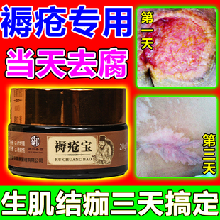褥疮专用药膏防老人臀部压疮腐烂老烂腿快速生肌结痂愈合外用药膏