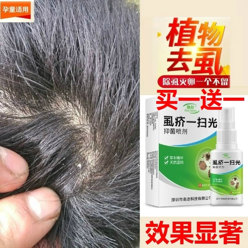 儿童去狮子跳蚤头药风子药 虱子 小女孩杀头上虱子药 阴虱体头发