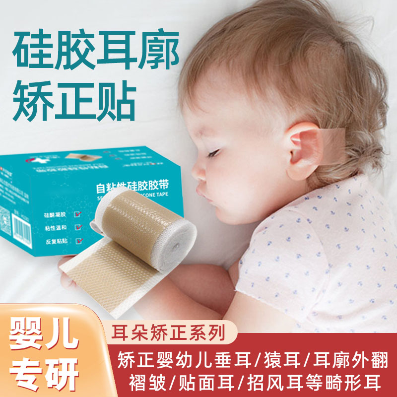 baby Ears Orthotic device Jug Auricular malformation fixed Silicone paste Newborn Pinna Eversion Stereotype Artifact cqin the Personal Care/Health/Massage equipment , Slimming , Posture supplies category - from Buy2taobao.com to provide professional Taobao agent buy service