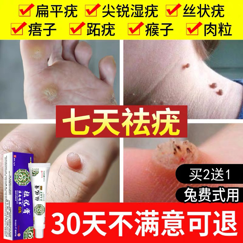 Filiform warts Flat face Grams of warts Burns Wart Remove men and womenin the OTC Drug/Medical Devices/Planning supplies , Health supplies , Skin disinfection Care (Eliminate) category - from Buy2taobao.com to provide professional Taobao agent buy service