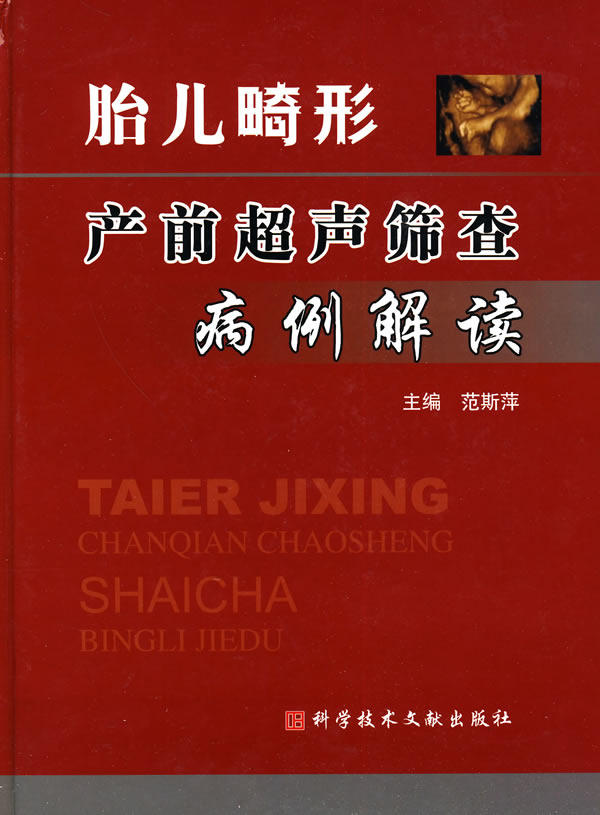 胎儿畸形产前超声筛查病例解读 9787502362775 范斯萍  主编 科技文献