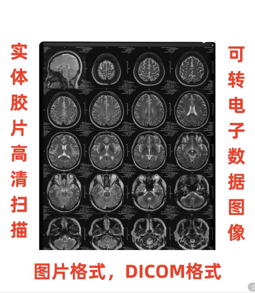 高精度胶片扫描仪，可将实体胶片扫描成图片格式或dicom数据格式