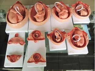 体内胎儿性别测试卡精确么