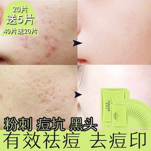 怎么去痘坑痘印_去痘印最有效的偏方_红色痘印和痘坑去不掉