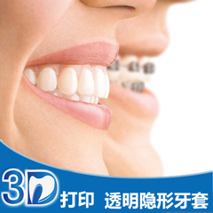 定制 成人隐形牙套 隐适美透明牙套 收牙缝 牙缝大