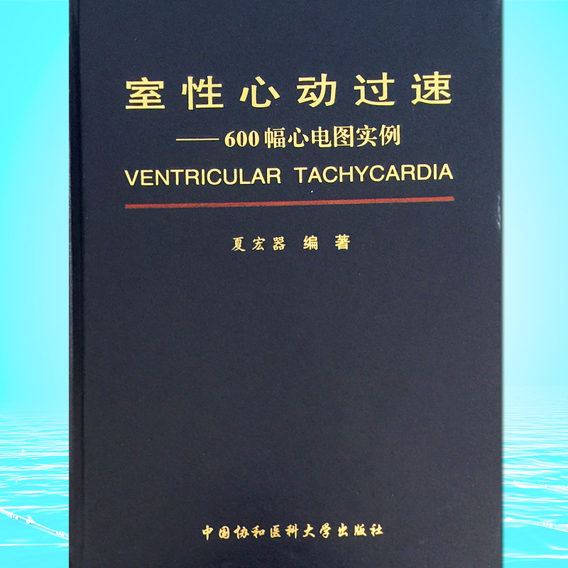 室性心动过速心电图图谱临床实用医学书籍 中国协和医科大学出版社