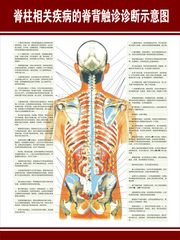 脊柱相关疾病的脊背触诊诊断示意图 医学脊椎健康按摩挂图 挂画