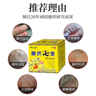 推荐汗疱疹手痒脱皮汗孢疹汗状孢疹专用治疗手足癣手脚上起小水泡