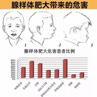 网红腺样体贴腺样体肥大矫正贴调理中药面容矫正器鼻塞穴位贴儿童