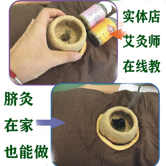 脐灸面碗盒脐灸灸具面底灸盒脐灸粉儿推拿店妇科调理脾胃保健脐灸