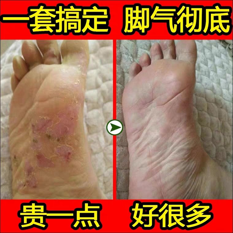 特价去脚气脚臭 泡脚粉