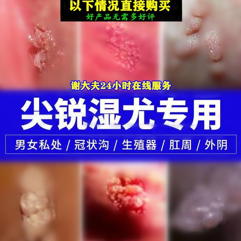 治疗犹博士犹霸王犹敌鬼臼毒素酊重组人干扰素凝胶软膏栓尖锐外用