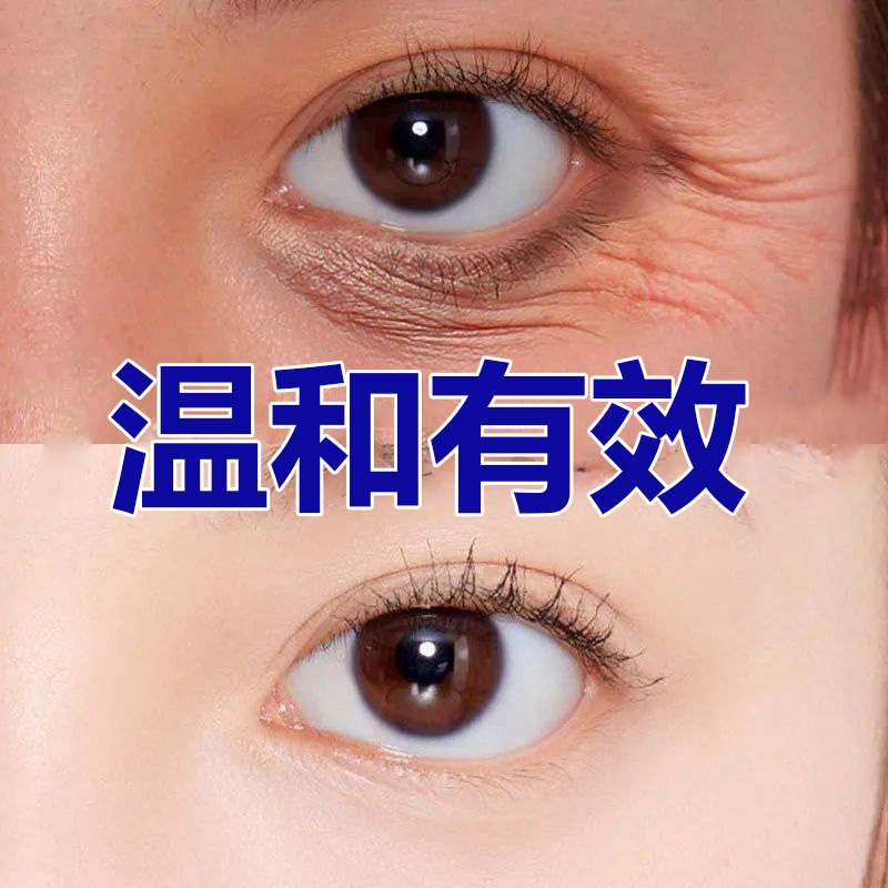 【留住美丽 不要眼纹】佰草世家眼霜黑眼圈眼袋细纹紧致抗皱