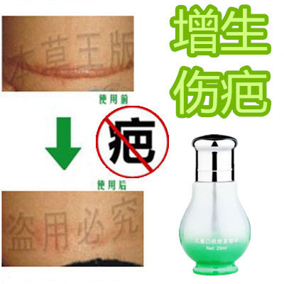 修复软化剖宫产隆起凸疙瘩液祛除手术开刀割伤疤痕印缝针产后药膏在类目 彩妆/香水/美妆工具, 遮瑕中 - 来自Buy2taobao.com提供专业的淘宝代购服务