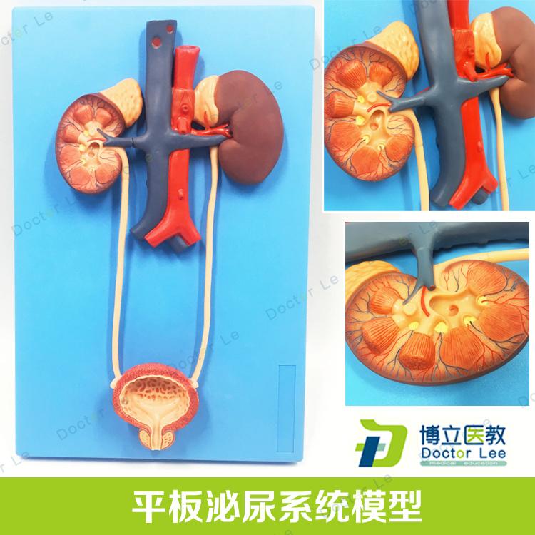 人体泌尿系统模型肾输尿t管膀胱尿道解剖模型医学泌尿科泌尿模型