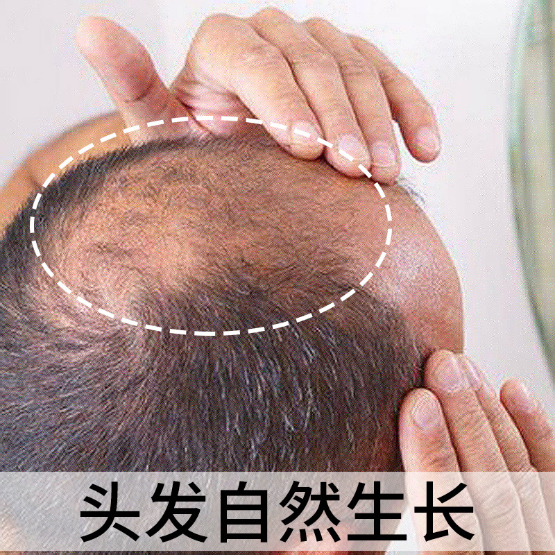 【同济堂-生姜洗发水】头发自然生长速度 变密变多变长 买2送1在类目 彩妆/香水/美妆工具, 男士彩妆(新), 男士阴影中 - 来自Buy2taobao.com提供专业的淘宝代购服务