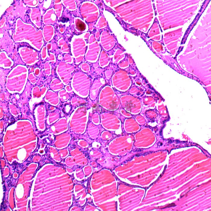 河南卓普 大学职院 医学院病理实验室专用 病理切片动脉粥样硬化