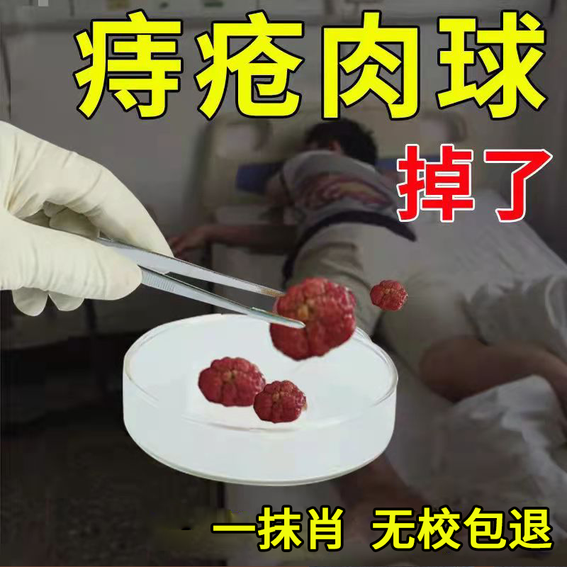 痔疮消肉球日本特效膏产后痔疮膏【正品】成人去痔疮坐浴中药膏