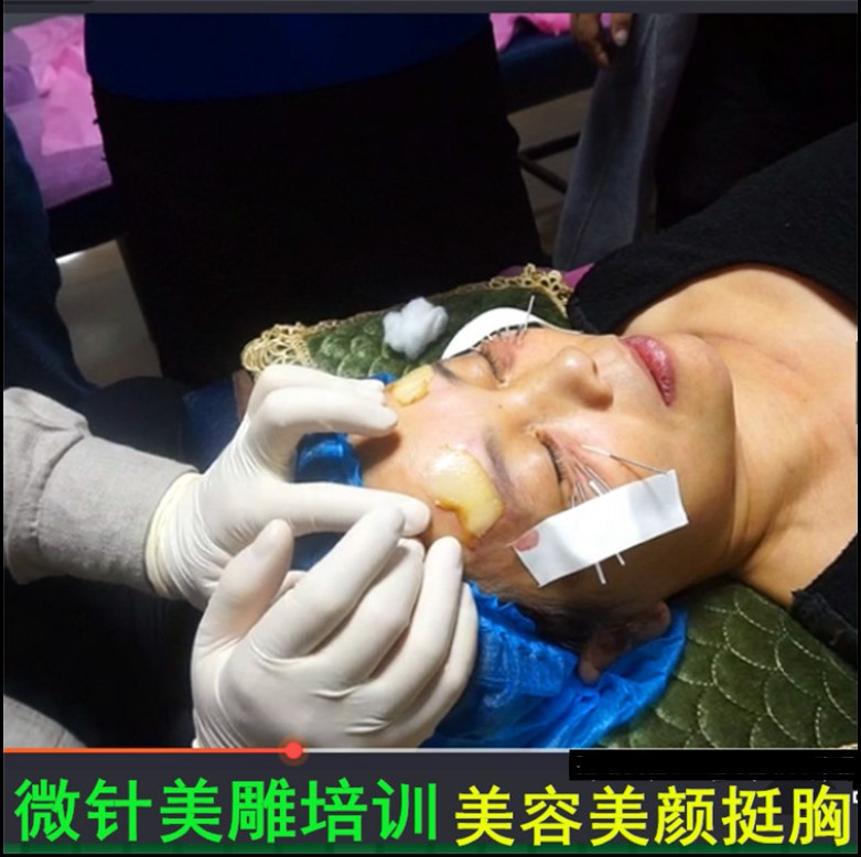 微针美雕美容美颜提胸挺胸面部提升培训视频理论及实操