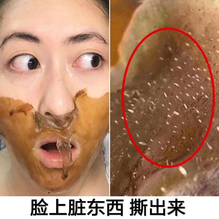 【买1送1】去98%面部毛孔拉圾 无效不要钱~去脏脸男女通用