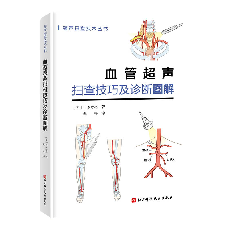 【当当网正版书籍】血管超声扫查技巧