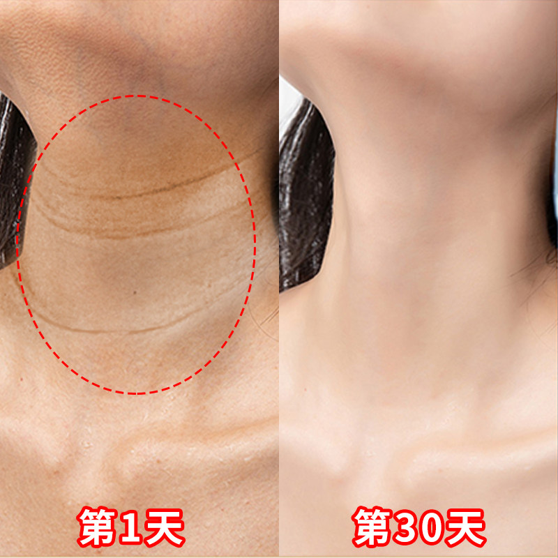 小红书推荐别让颈纹暴露了你的年龄还你天鹅颈去颈纹神器