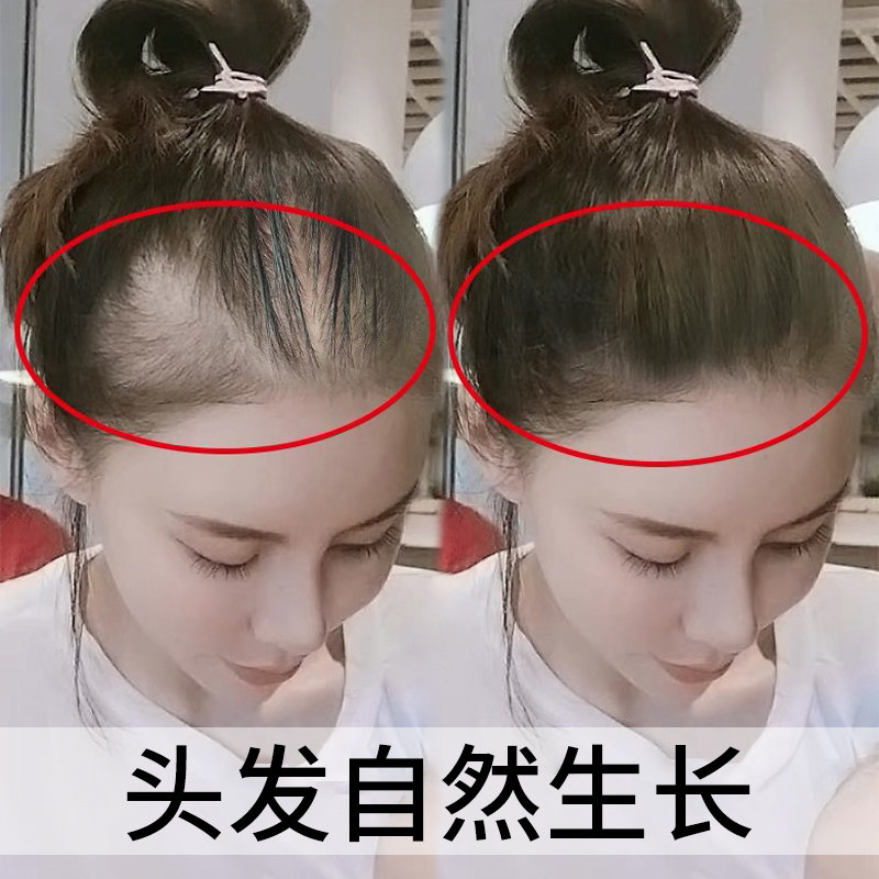 薇娅爆推再见秃头头人头发自然生长变密变多化妆