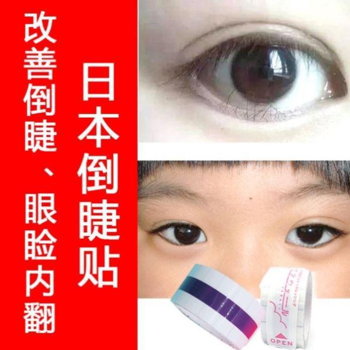 倒睫毛小学生婴儿改善倒睫安全睑外翻胶布脱敏眼睑贴防过敏运动正|msdalam kategori Kamus elektronik/buku kertas elektronik/alat tulis, Produk pelekat, pita/pita pelekat/jalur - dari Buy2taobao.com untuk memberikan perkhidmatan ejen Taobao profesional membeli