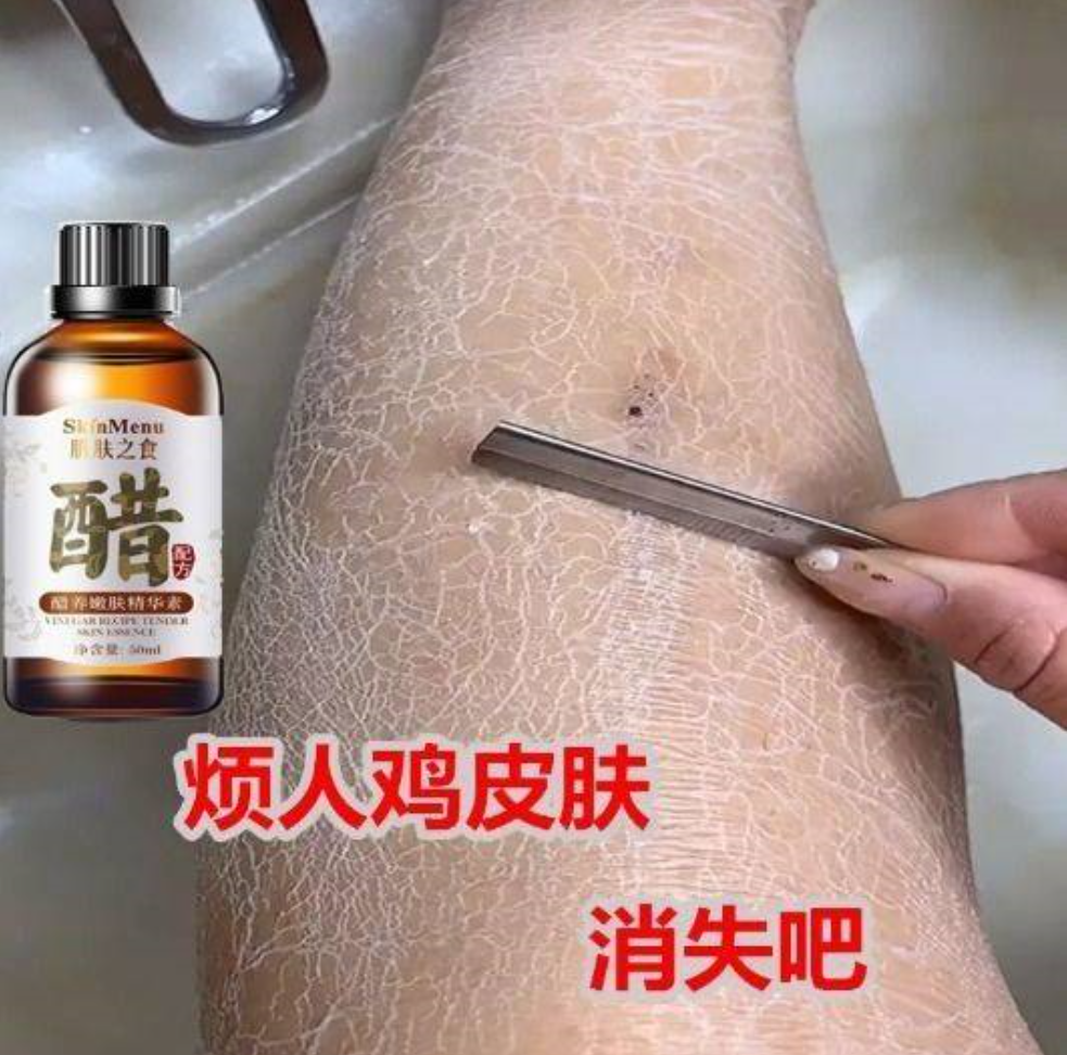 ȲƤֲ_  Ƥ䰵 ֲ_ȲƤֲ