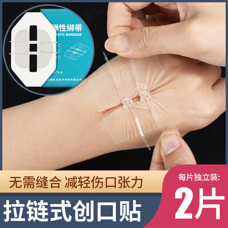 拉链式创可贴减张贴减张力器伤口贴免缝合缝针式疤痕皮肤术后创口