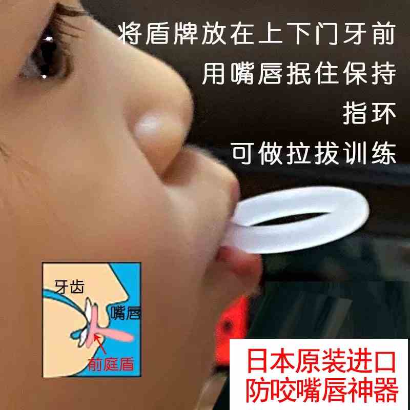 宝宝防咬下嘴唇神器夜间防儿童咬嘴唇矫正器小孩咬纠正器嘴巴闭合