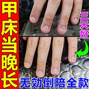 甲床修复生长液指甲受损萎缩甲肉分离空甲断裂竖纹护甲油甲床增长