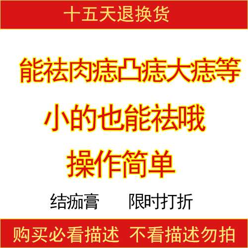去志点志痣正品-特价促销-优惠券领取-价格|多少钱|什么牌子好-35优惠