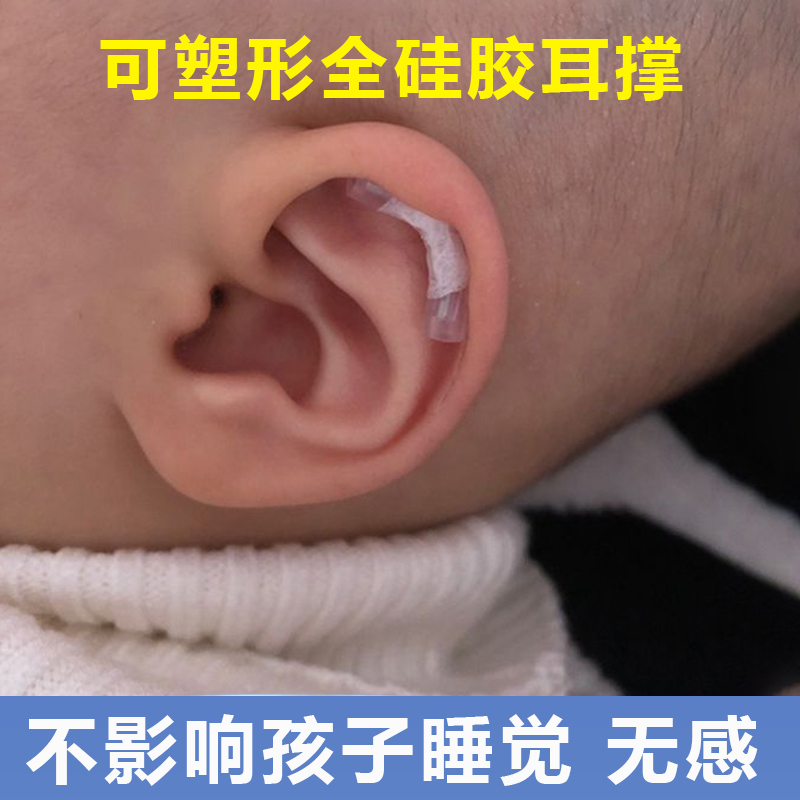 婴儿耳朵矫正器新生的儿耳廓矫形贴纠
