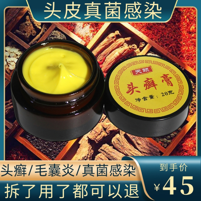 头皮银屑癣去头藓药膏头皮藓头皮清洁抗真菌头螨癣去大块头皮屑