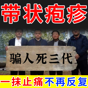 马寺源带状疱疹后遗症神经痛外用膏蛇盘疮毒蛇缠腰发热痒隐私发货