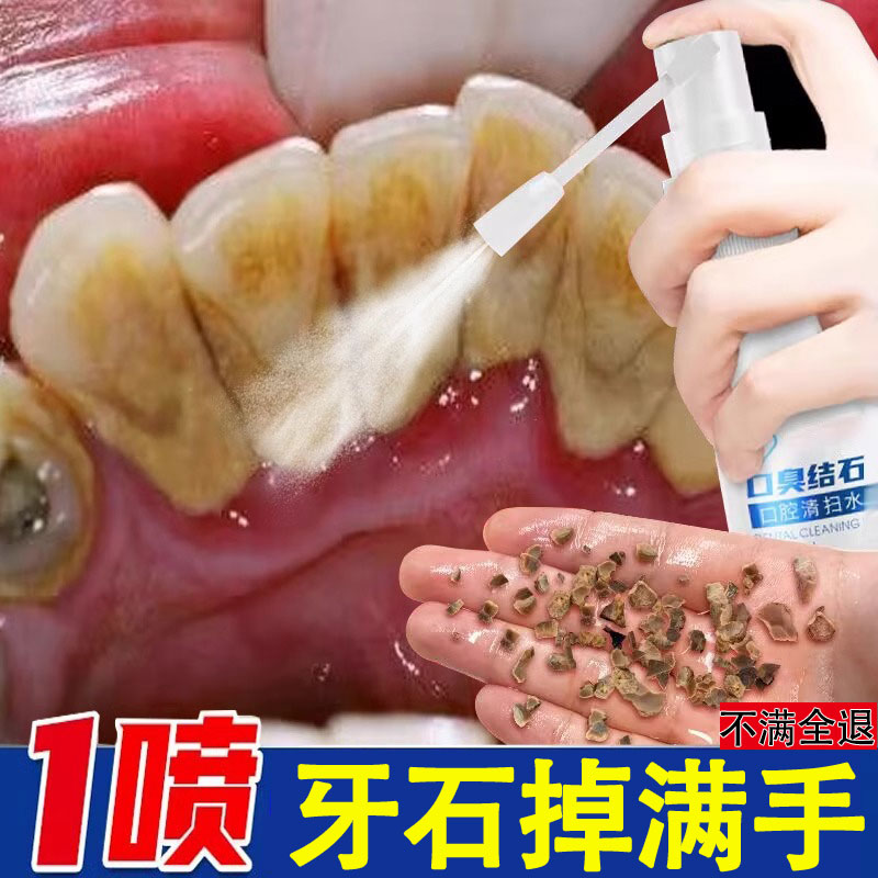 【牙科推荐】牙齿污垢清洁神器 去黄去结石烟渍茶渍 男女通用