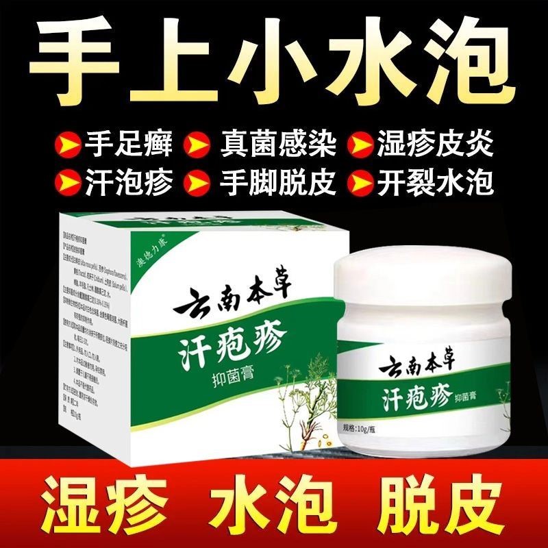 云南本草汗孢疹汗泡珍药膏专用汉状真菌感染手气手上起小水泡