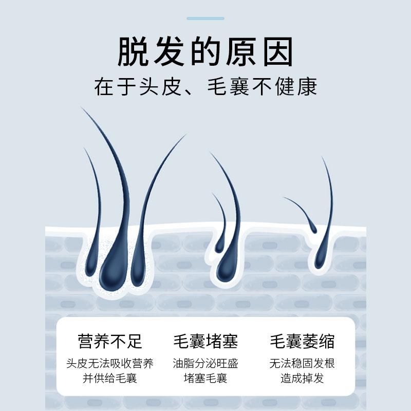 EWF琴叶脱控油洗发固发蓬松发强韧水发根清爽顺防滑男女HGD官方正